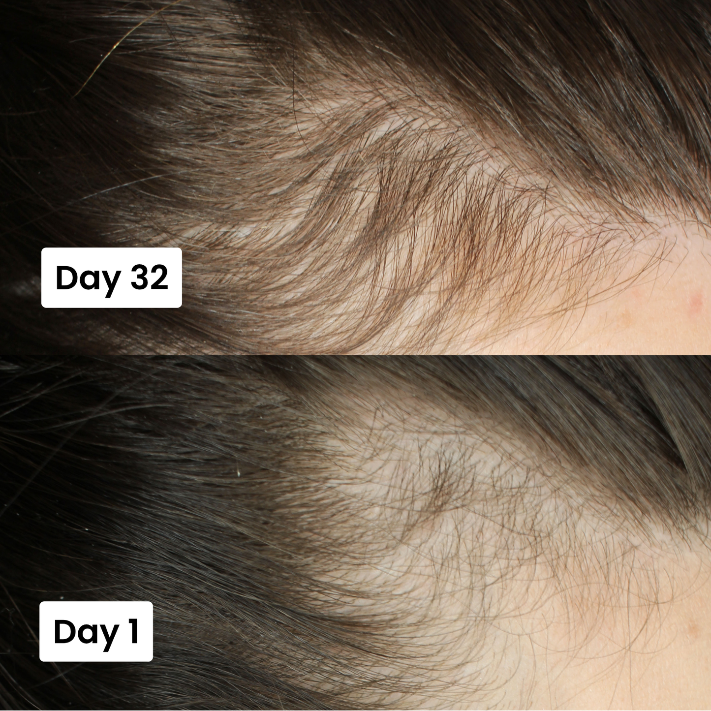 Scalpy® Hair Ampoule