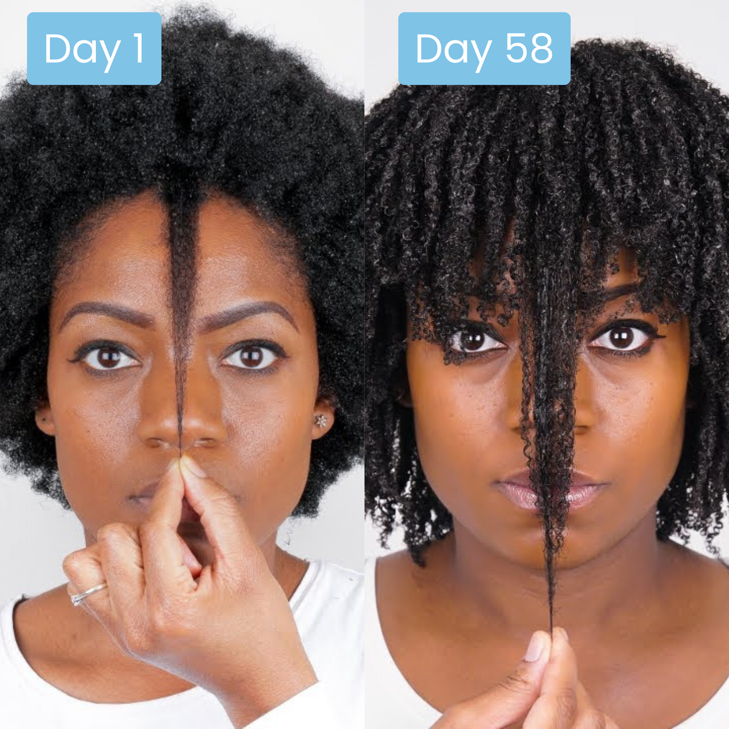 Scalpy® Hair Growth Ampoule