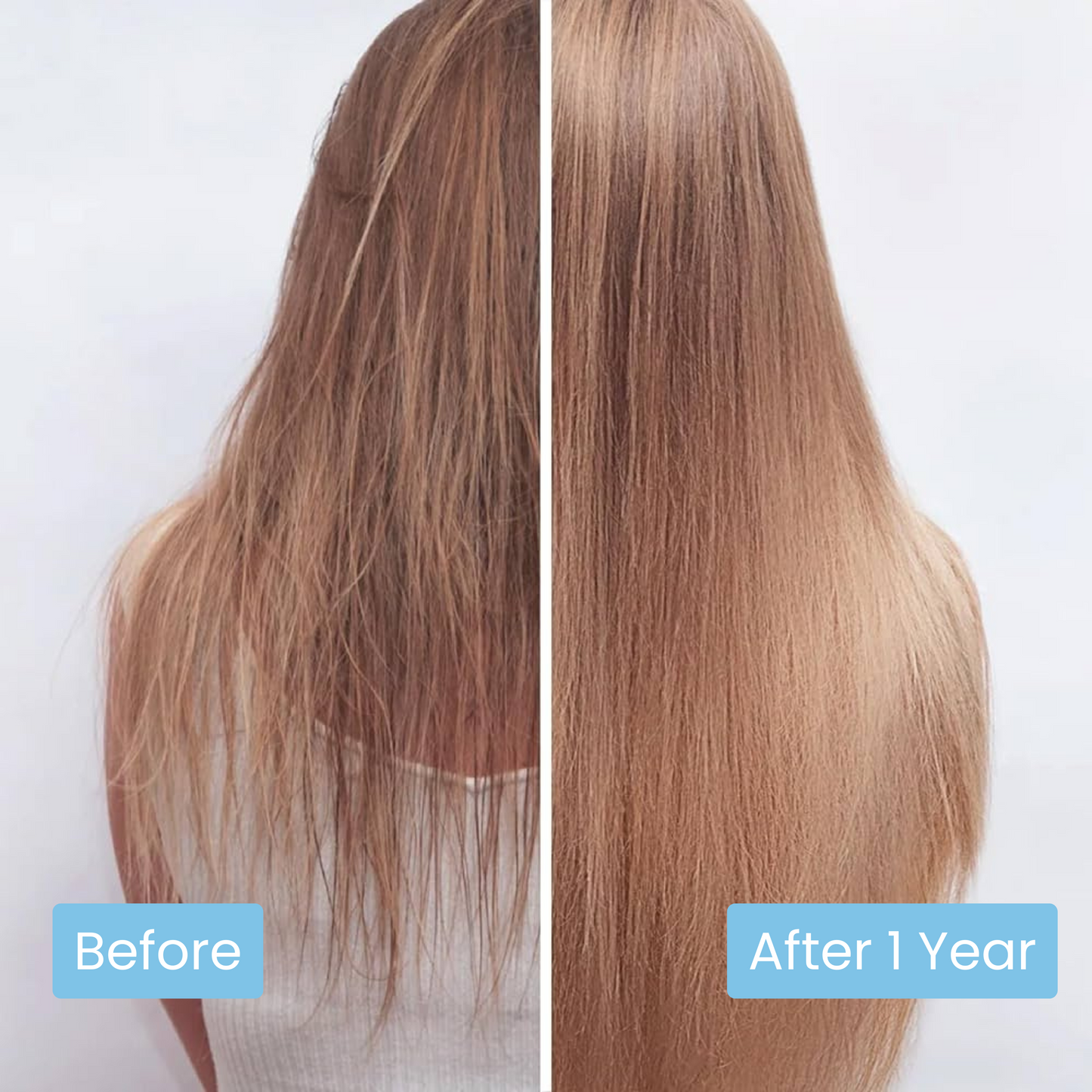 Scalpy® Hair Growth Ampoule