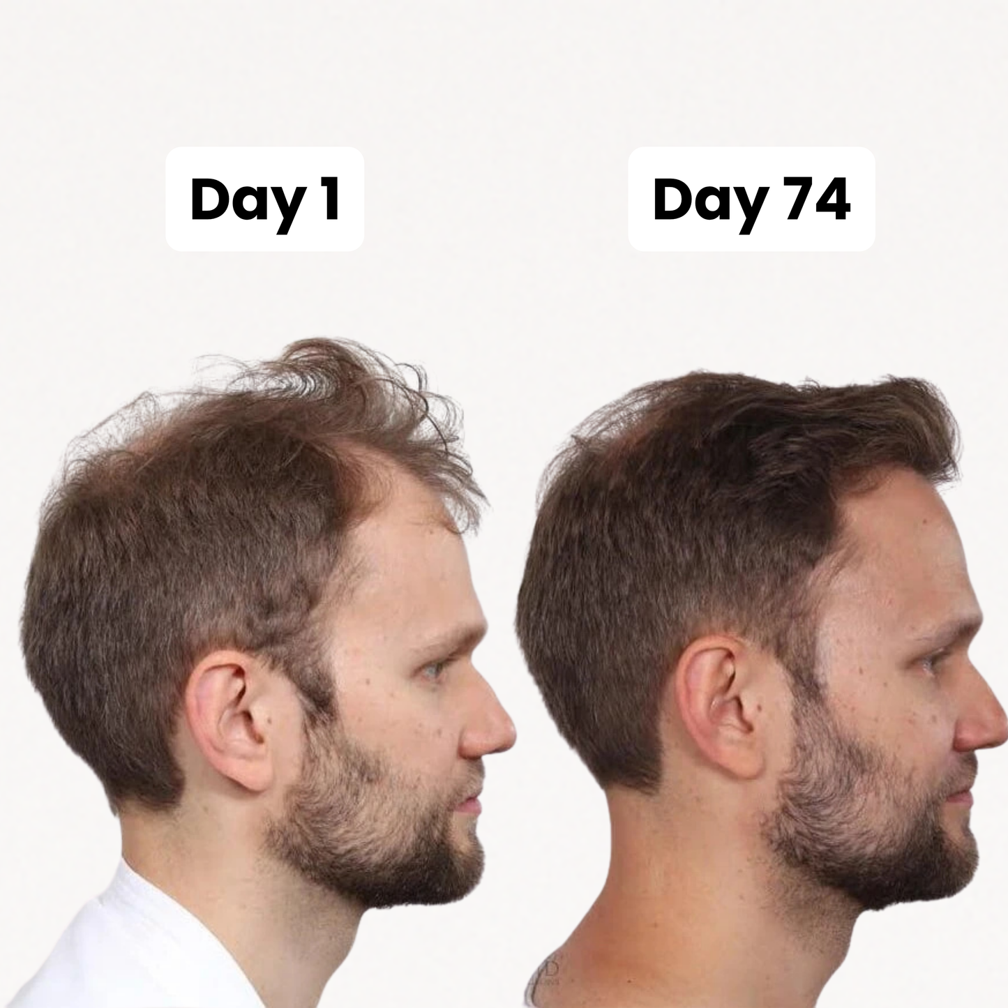 SCALPY │ Tri-Fix® System
