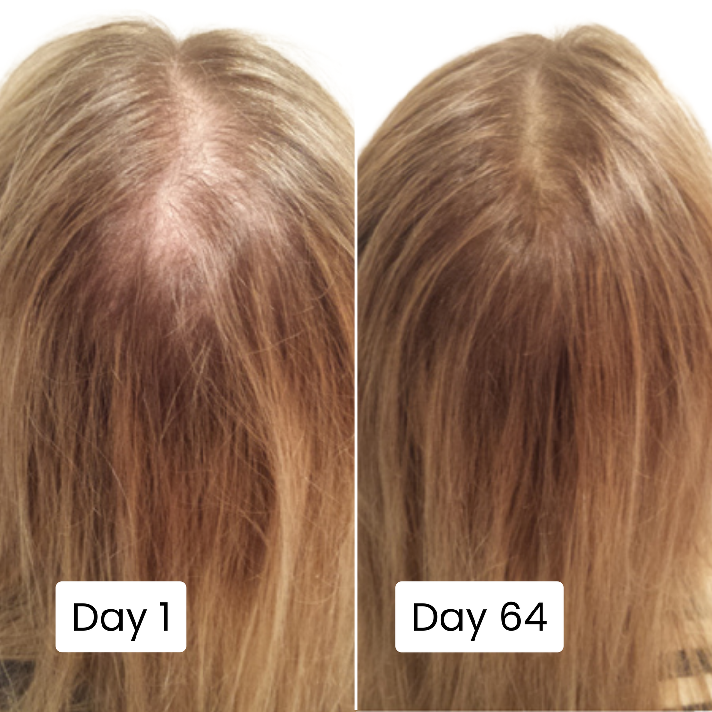 Scalpy® Hair Growth Ampoule