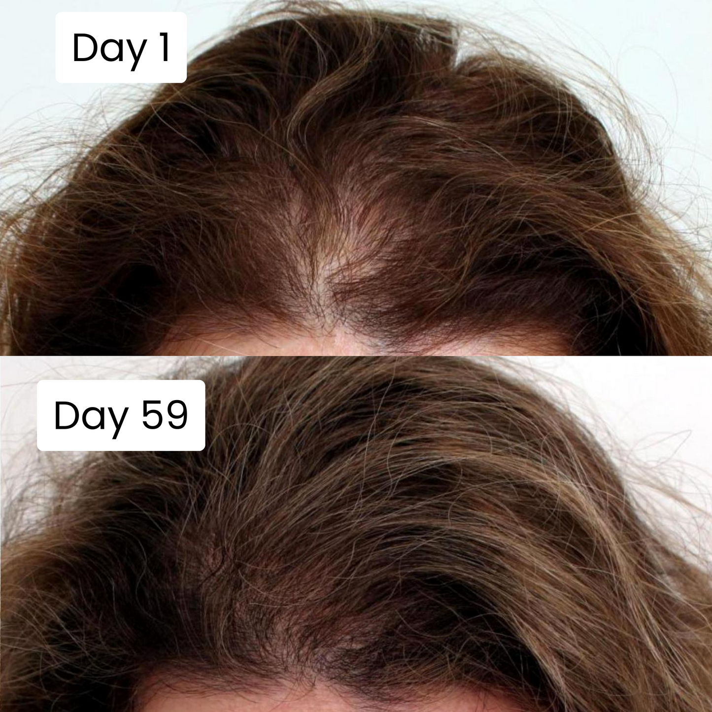 Scalpy® Hair Growth Ampoule