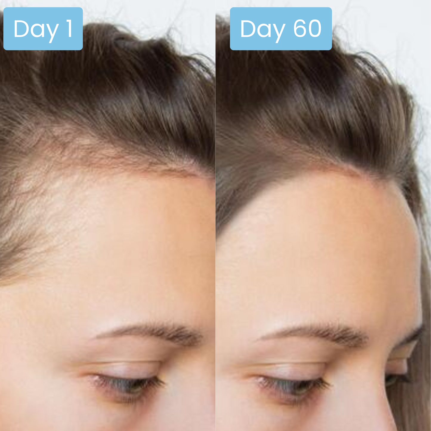 Scalpy® Hair Growth Ampoule