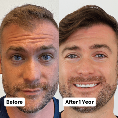 SCALPY │ Tri-Fix® System