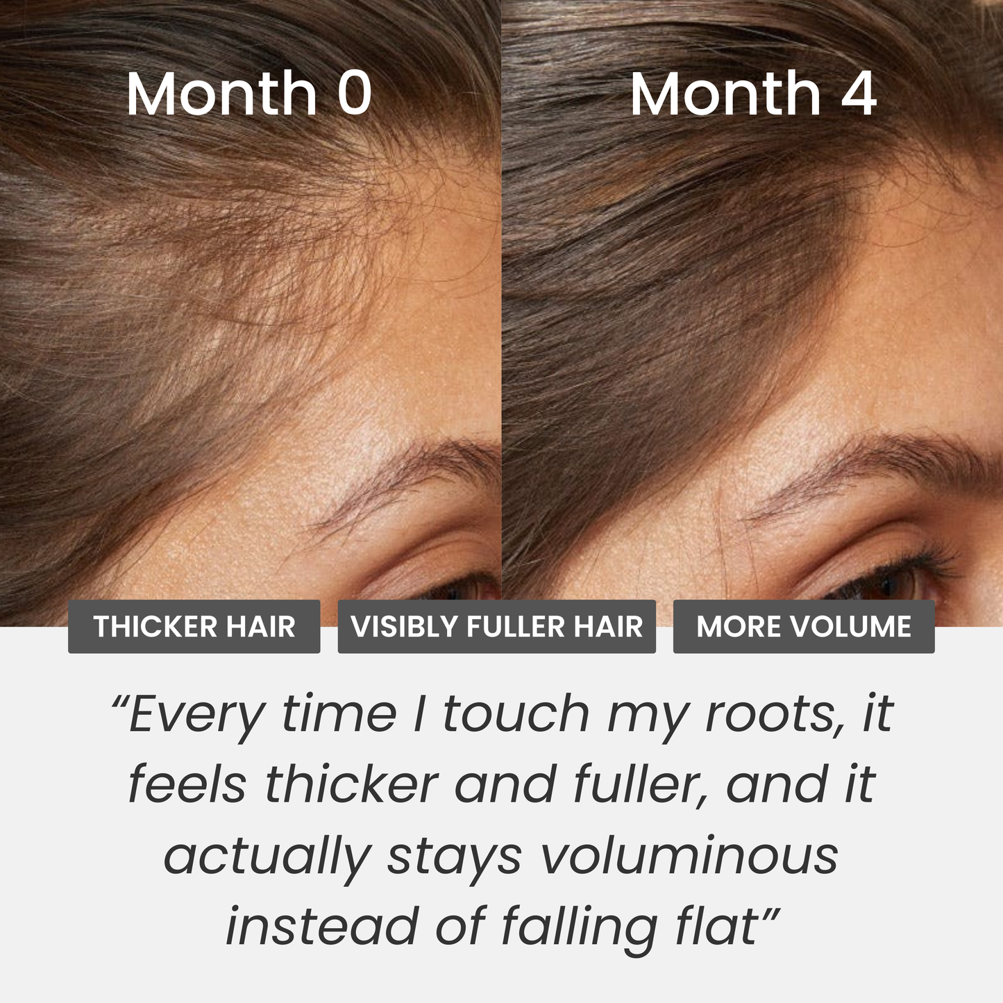Micro Stimulation Roller