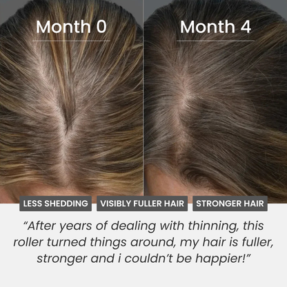 Hair Density Roller