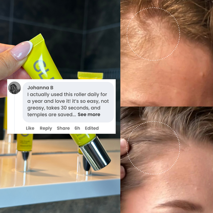 Hair Density Roller