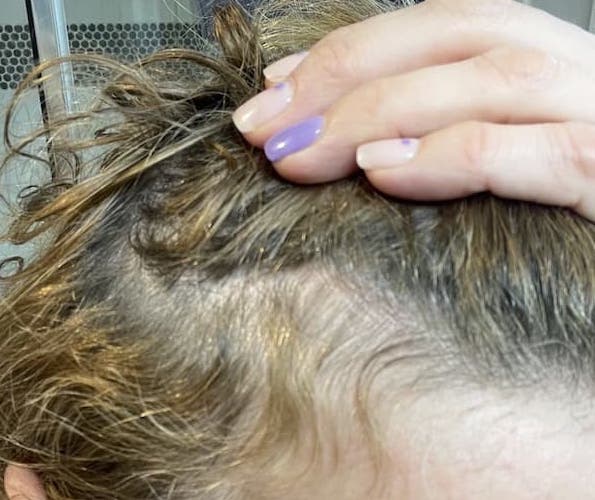 baby hairs blog